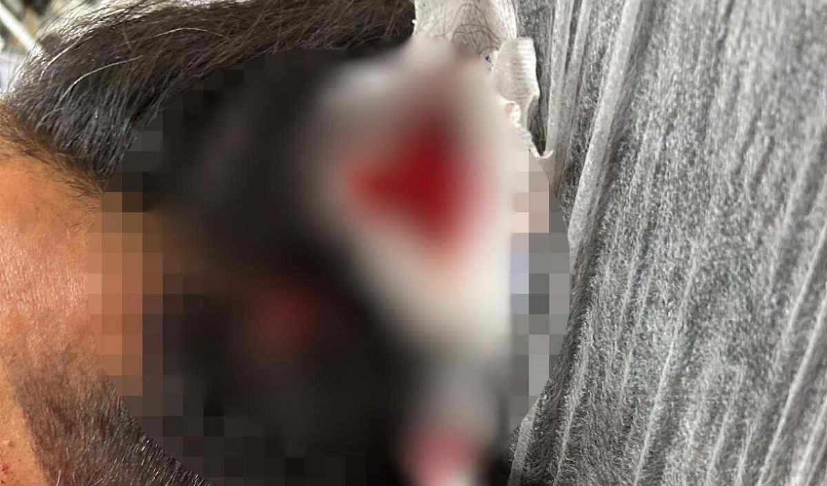 Yorgun Merminin Kurbanı Oldu! Döner Keserken Başına Saplandı (2)